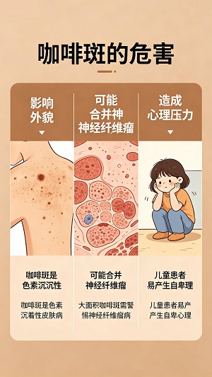 咖啡斑好治吗？南京胎记专科医院